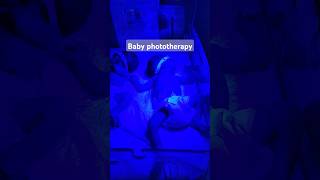 Twins baby 👶😲 Phototherapy  shorts nicu phototherapy Twinsbaby [upl. by Sido]