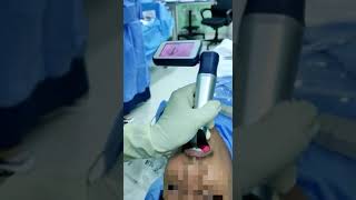 Reusable Video Laryngoscope Routine Airway Clinical intubation  Video Assisted Intubation [upl. by Lecirg154]