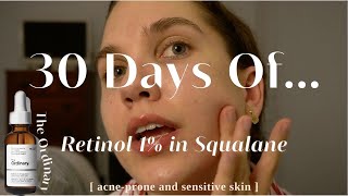 I Used The Ordinary 1 Retinol in Squalane For 30 Days  Acne Scarring Before and After [upl. by Annoyed471]