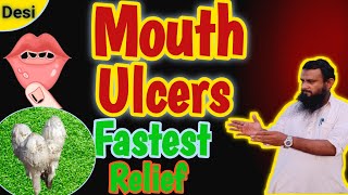 munh ke chhale  How to Heal Mouth Sores Faster  mouth ulcers [upl. by Bertine]