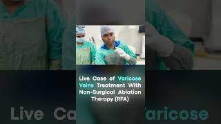 Live Case Treating Varicose Veins with NonSurgical Ablation  Varicose Veins Treatment in Jaipur [upl. by Tebor205]