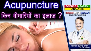 ACUPUNCTURE किन बीमारियों का इलाज   ACUPUNCTURE THE MEDICAL FACTS [upl. by Scheers90]