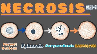 “Nuclear Metamorphosis Exploring Pyknosis Karyorrhexis and Karyolysis” Necrosis part 2 [upl. by Aili883]