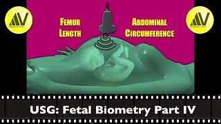 Fetal Biometry Part IV Femur Length amp Abdominal Circumference [upl. by Celinka]