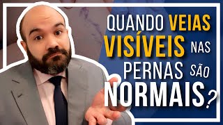 🔴 Veias visíveis nas pernas Quando são NORMAIS [upl. by Naoj]