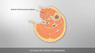 Fibula osteocutaneous flap harvest [upl. by Elberfeld517]