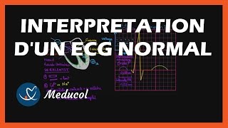 Electrocardiogramme ECG  interpretation dun ECG normal [upl. by Latrina121]