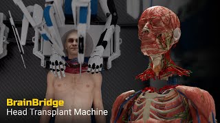 Head Transplant Machine – BrainBridge [upl. by Auliffe]