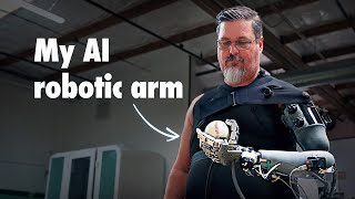 Theyre Building Him an AI Powered Robotic Arm [upl. by Alonso]