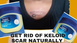 how to get rid of keloid without surgery  keloid treatment at home [upl. by Ingham]