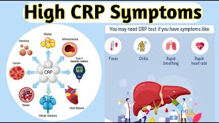 High crp symptoms [upl. by Aloiv]