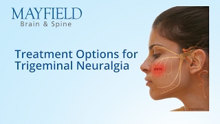 Facial Pain Treatment Treatment Options for Trigeminal Neuralgia [upl. by Uase439]