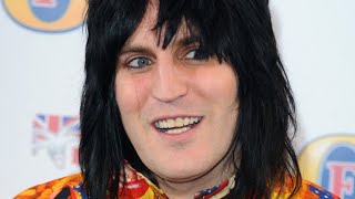 The Untold Truth Of Noel Fielding [upl. by Endo]