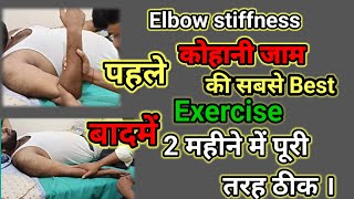 Stiffness Elbow joint कोहनी जाम Best exercises [upl. by Acyssej]