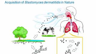 Dimorphic Fungi Blastomycosis Hot Topic [upl. by Hallvard37]