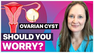 Ovarian Cysts Everything You Need to Know by Dr Lora Shahine [upl. by Naida]