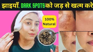 1 Week Challengeझाइयां दाग धब्बेDARK SPOTS 100 गायबपाये जादुई निखार pigmentation Remedy [upl. by Ykcaj651]