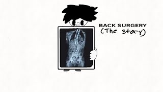 back surgery the story [upl. by Lena244]