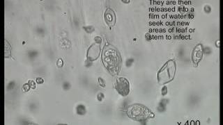 Zoospores swimming Phytophthora sp [upl. by Aleel]