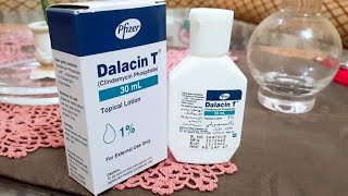 Dalacin T Lotion for acne Review usage Benefit Price Remove Pimples acne best solution for acne [upl. by Elockcin310]