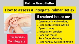 Palmar grasp reflexsolve writing amp speech issueshow to assess amp integrate palmar reflex [upl. by Susan360]