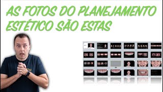 Quais fotografias usar para DSD ou planejamento estético e como usar para comunicar com equipe [upl. by Laemsi791]