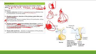 Hypopituitarism  Endocrine System  Step 1 Simplified [upl. by Ycnaf]