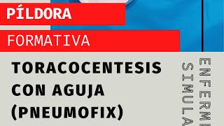 Toracocentesis con aguja Uso del pneumofix [upl. by Neffirg]