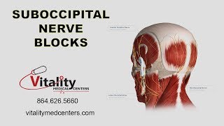 Suboccipital Nerve Blocks to Treat Occipital Neuralgia Explained by John E Stavrakos MD [upl. by Voltmer]