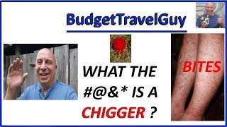 What are CHIGGERS how can you spot them and how do you get rid of them Vanlife RV Life Camping [upl. by Padriac]