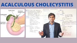 ACALCULOUS CHOLECYSTITIS  Quick Review  By Pramil Cheriyath MD [upl. by Zampardi]