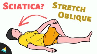 3 Best Sciatica Exercises for Sciatica Pain Relief [upl. by Olinde]