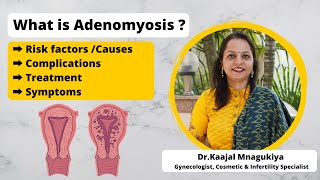 What is Adenomyosis   Symptoms Risk factors Causes Treatment  DrKaajal Mangukiya [upl. by Bara161]