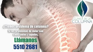 Problema de columna desviada 🏥 escoliosis lumbar [upl. by Charmine]