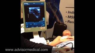 Ultrasound Guided Hip Injection [upl. by Hi26]