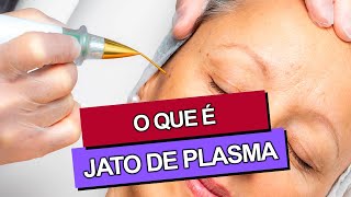 JATO DE PLASMA Antes e Depois [upl. by Blalock]