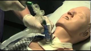 Closed suction of a tracheostomy tube [upl. by Yditsahc6]