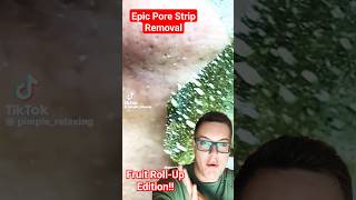 EPIC PORE STRIP REMOVAL  Fruit RollUp Blackhead Removal 😂 shorts [upl. by Anikas]