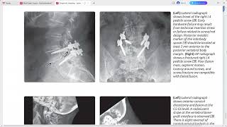 SPINE IMAGING DIAGNOSTIC IMAGING SERIES [upl. by Seaton]