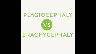 Plagiocephaly vs Brachycephaly [upl. by Grochow]