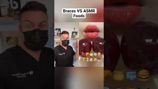 Orthodontist Reacts ASMR Foods VS Braces [upl. by Gwenni]