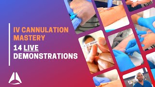 Intravenous IV cannulation compilation with demonstration of 14 procedures [upl. by Behm]