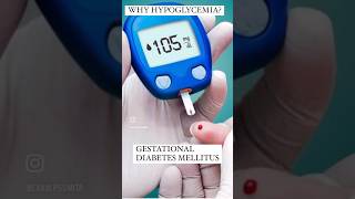 Gestational diabetes examhypoglycemia [upl. by Amsa]