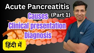 Acute Pancreatitis एक गंभीर बीमारी Acute Pancreatitis in hindi [upl. by Renferd]