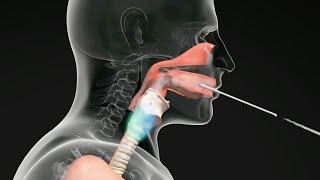 How do Straw Exercises Help the Voice Get Better voicetherapy [upl. by Erbas]