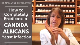 How to Completely Eradicate a Candida Albicans Yeast Infection [upl. by Ezekiel365]