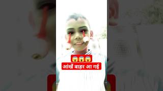 😱Eyes Popped Out shorts short youtubeshorts shortfeed youtubeindia eyes [upl. by Janyte]