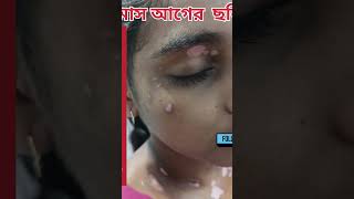 Vitiligo treatment safeed daag ka ilajBefore After result Just 1 monthhair regrowth 9734984030 [upl. by Brod648]