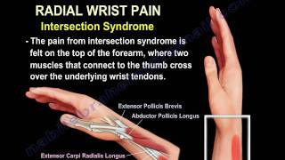 Wrist Paincauses and treatmentPart 2  Everything You Need To Know  Dr Nabil Ebraheim [upl. by Eydnarb263]