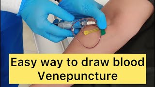 How to draw blood Venepuncture Blood sample for PRP Platelet rich plasma venepuncture blooddraw [upl. by Atinaj724]